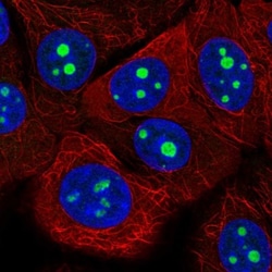 KRI1 Antibody, Novus Biologicals 25ul | Buy Online | Novus Biologicals | Fisher Scientific